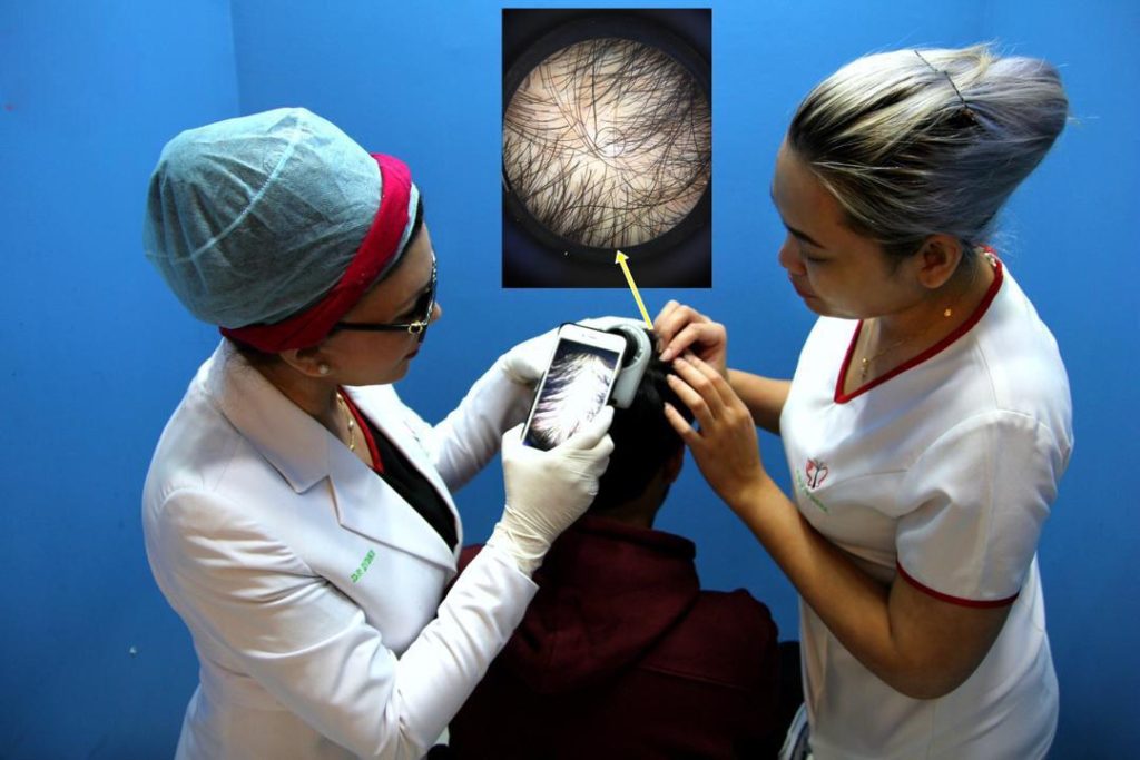 Scalp Analysis at Hair Transplant Malaysia