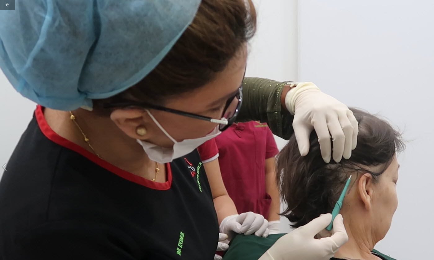 Dr Inder harvesting Micro-grafts At Hair Transplant Centre Malaysia.