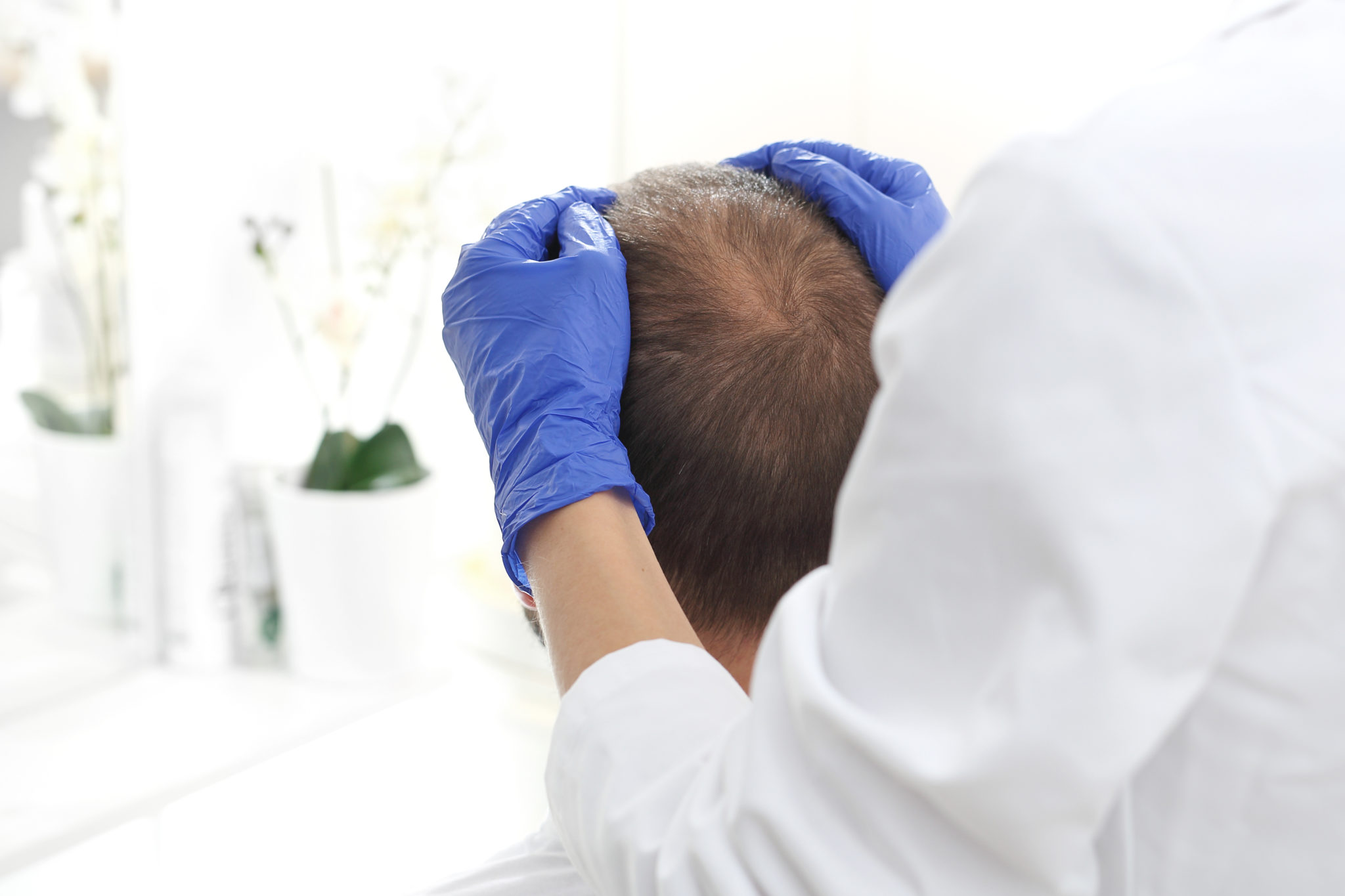 Doctors Scalp inspection