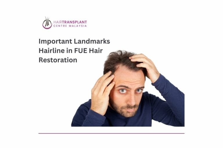 Important Landmarks Hairline in FUE Hair Restoration