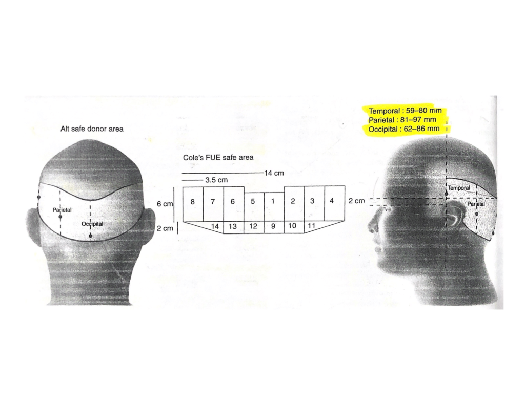 Safe Hair Donor Area