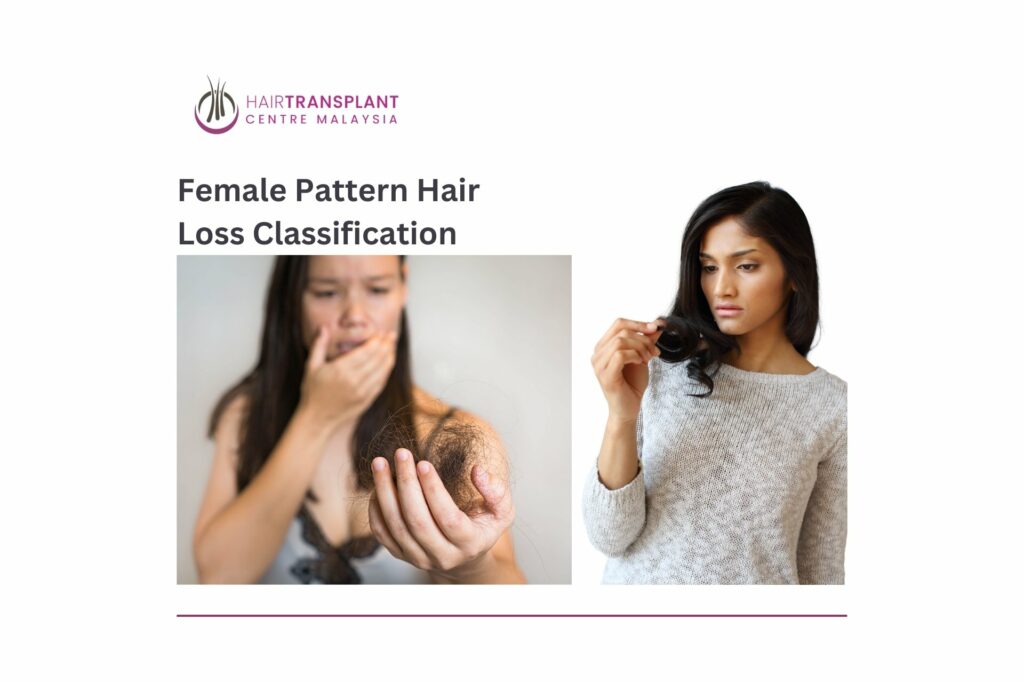 Female Pattern Hair Loss Classification