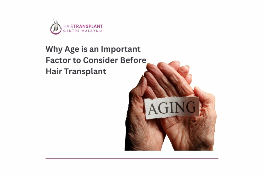 Why Age is an Important Factor to Consider