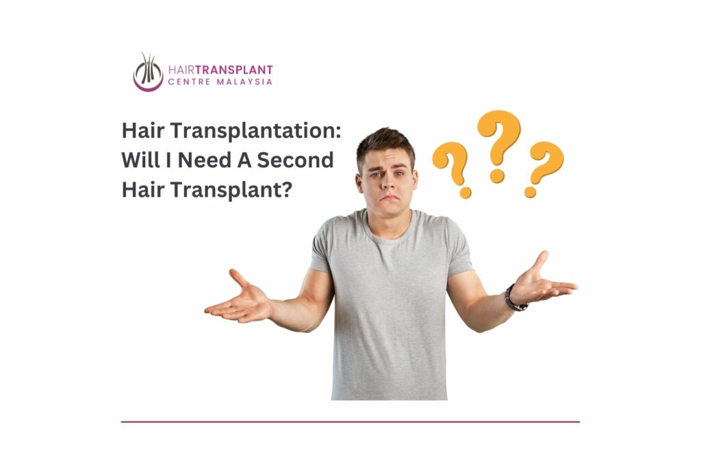 Hair transplant will i need a second hair