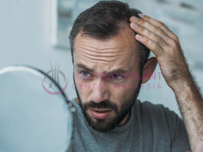 Can Hair Loss be Caused by Antidepressants