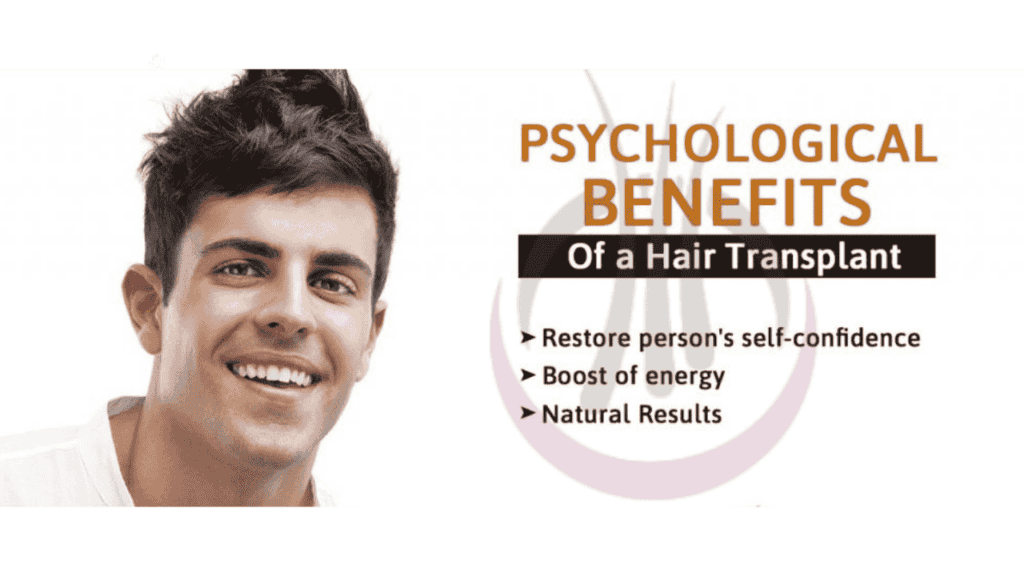 Benefits of Hair Transplant