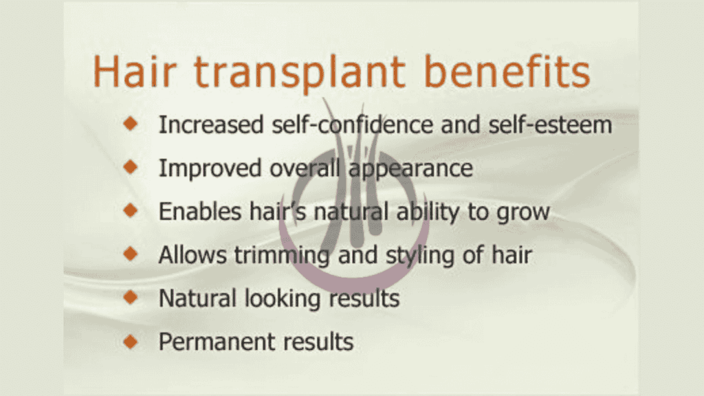 Benefits of Hair Transplant