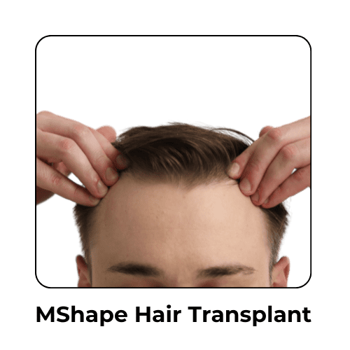 MShape Hair Transplant in Malaysia