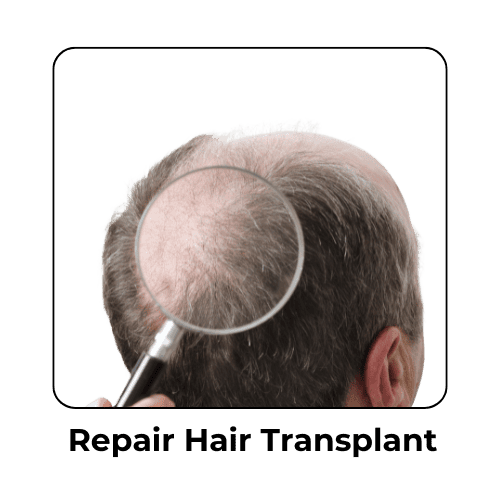 RRepair Hair Transplant