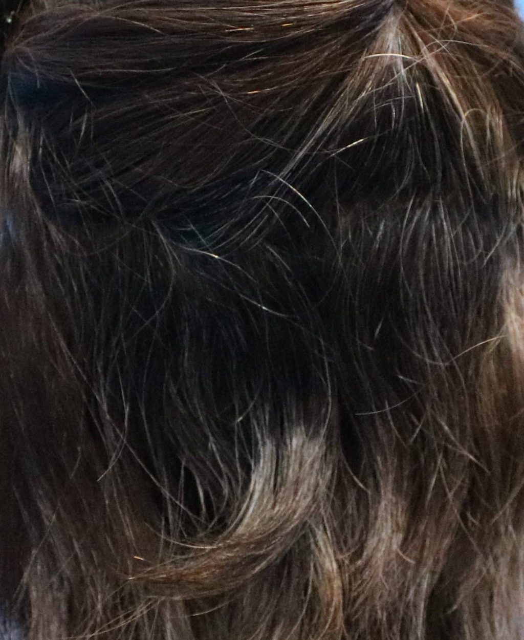 Female Hair Loss Back Angle Result